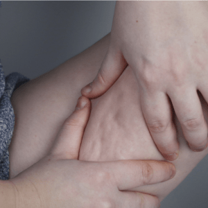 Los 5 mejores tratamientos contra la celulitis que funcionan