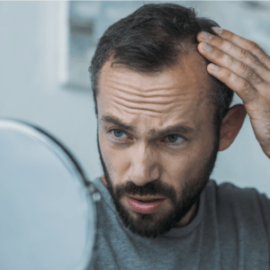 ¿Por qué se me cae el pelo? Salus Center Madrid